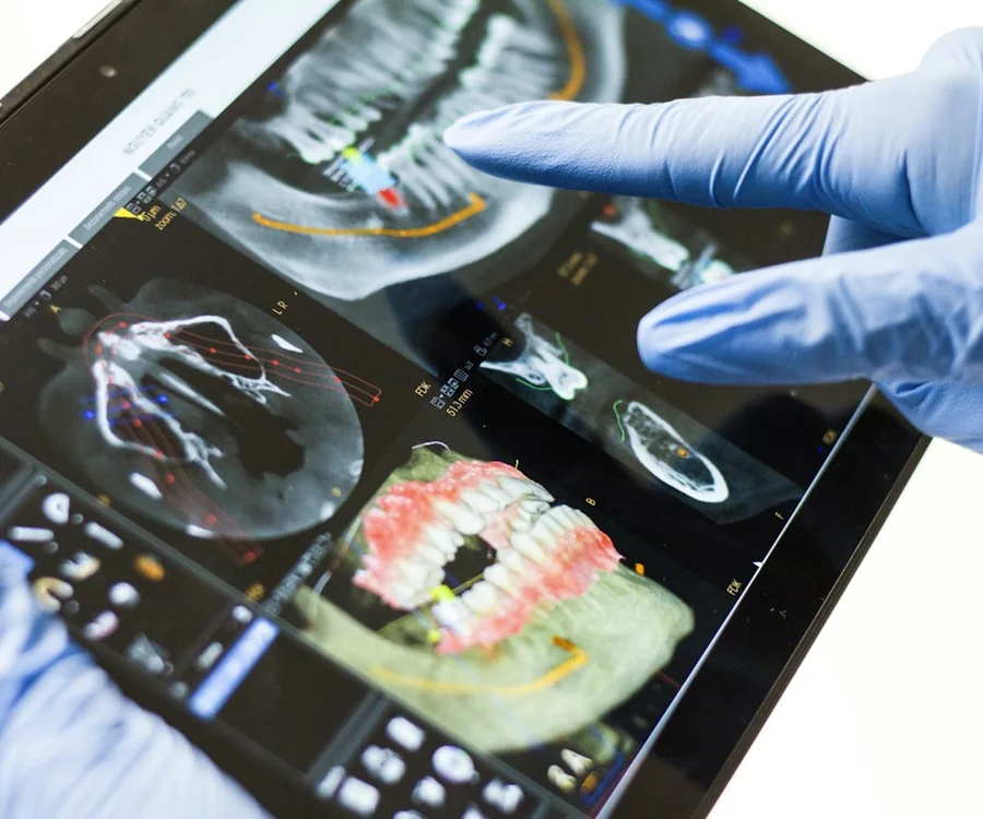 Escáner intraoral mostrando un modelo 3D de la dentadura