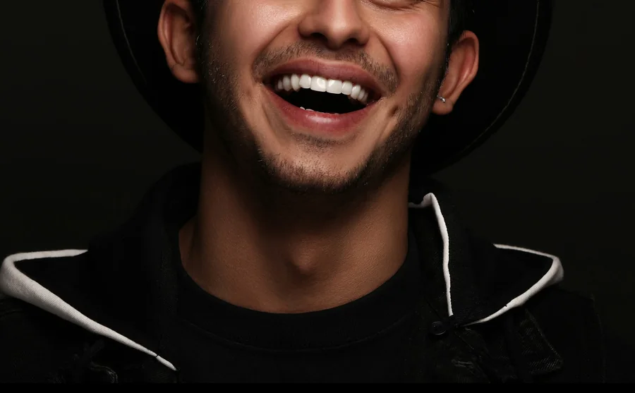 Sonrisa después del tratamiento de blanqueamiento